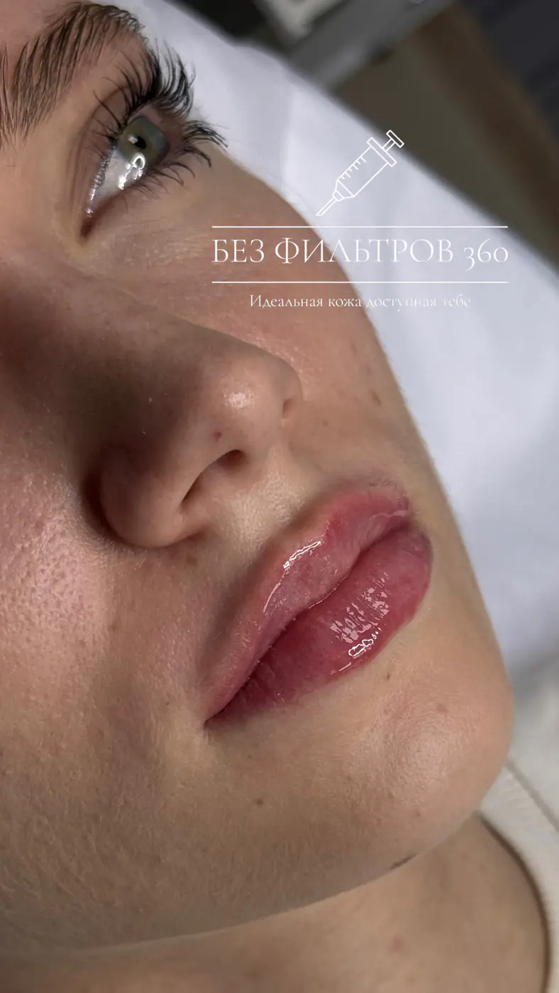 Работа клиники Без фильтров 360, снимок 5
