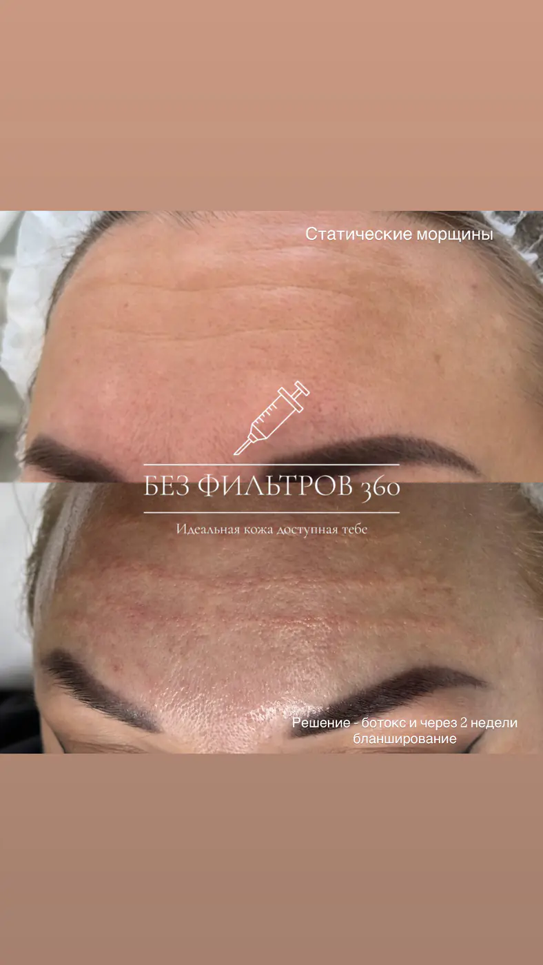 Работа клиники Без фильтров 360, снимок 8